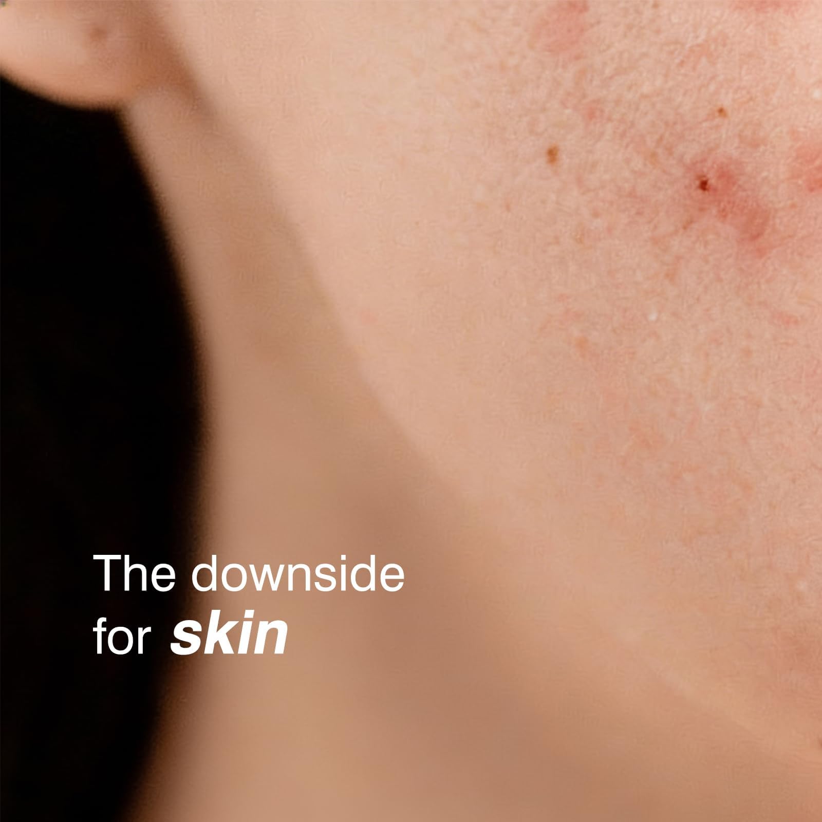 Sumax Relief Serum on skin, demonstrates fast absorption and comfortable finish.