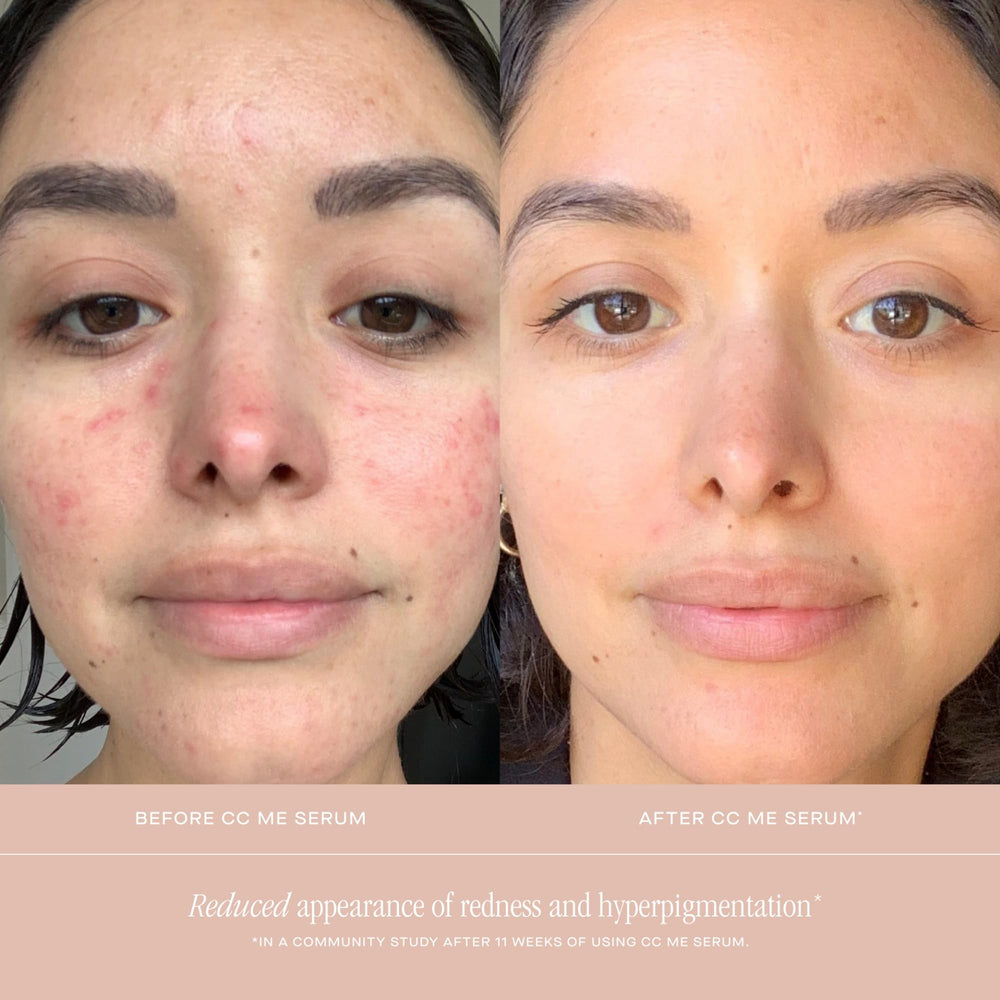 Summer Fridays CC Me Serum on skin with radiant glow potential