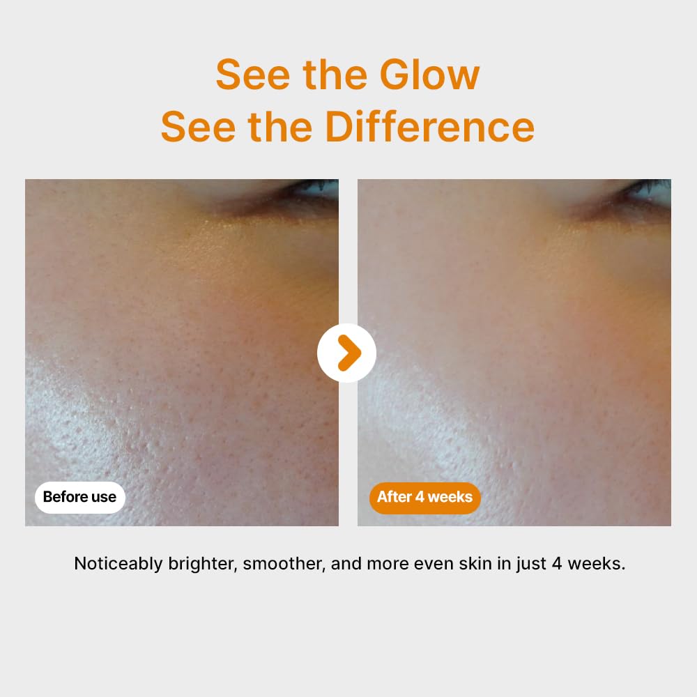 SUMSAE formula featuring adenosine and panthenol supports skin resilience.