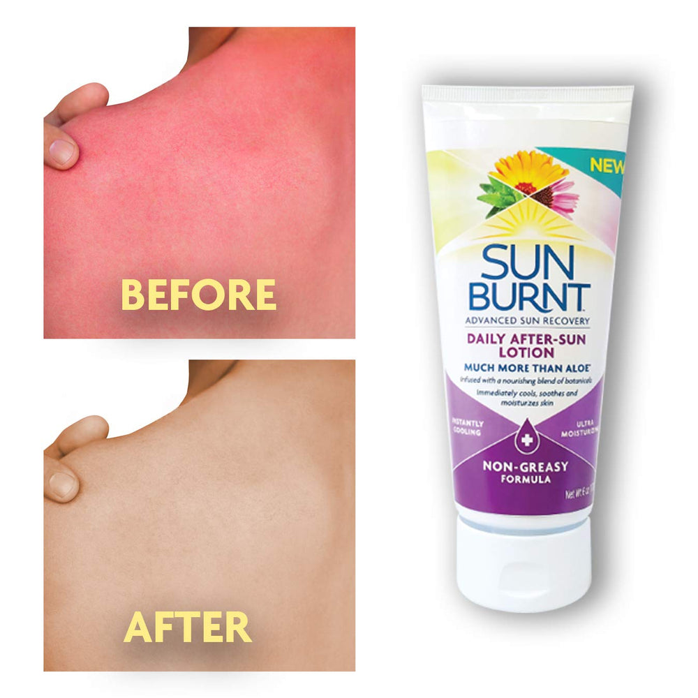 SunBurnt Lotion demonstrates fast absorption with a non-greasy finish on skin.