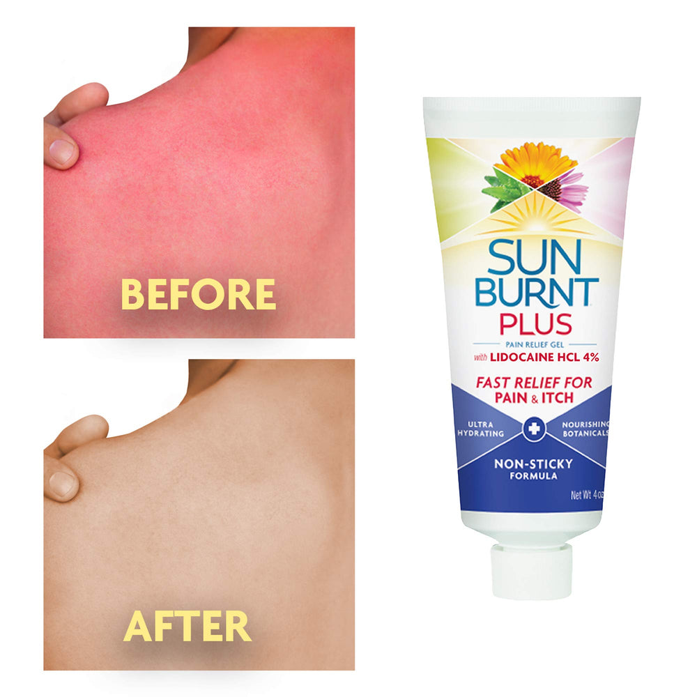 Sunburnt Plus aloe vera nutritivo, hidratación profunda para piel seca.