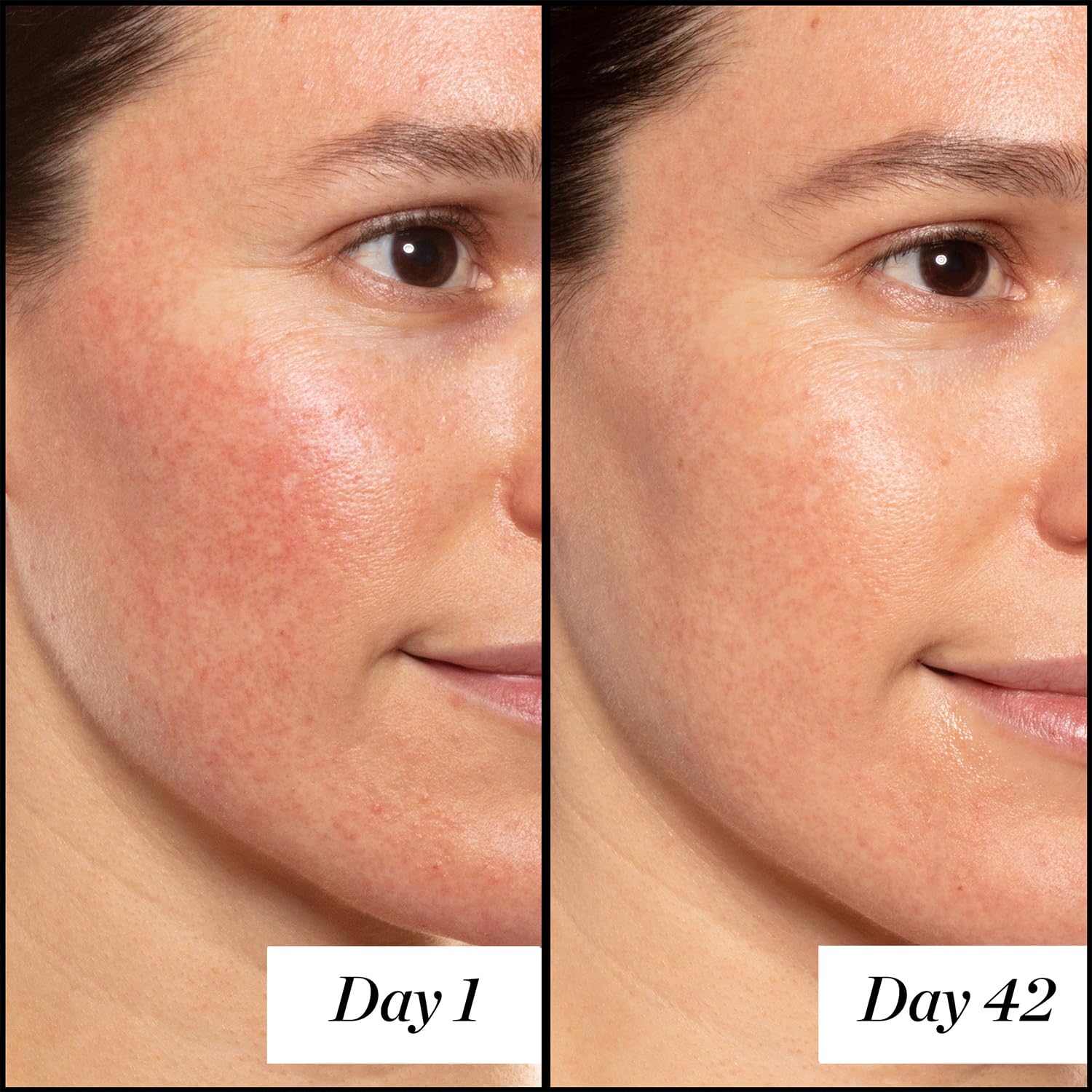 CoQ10 ingredient note in Sunday Riley A+ Serum for antioxidant support