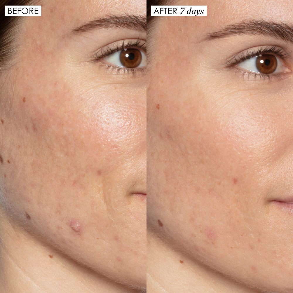 Sunday Riley Good Genes serum texture on skin shows creamy, exfoliating consistency.