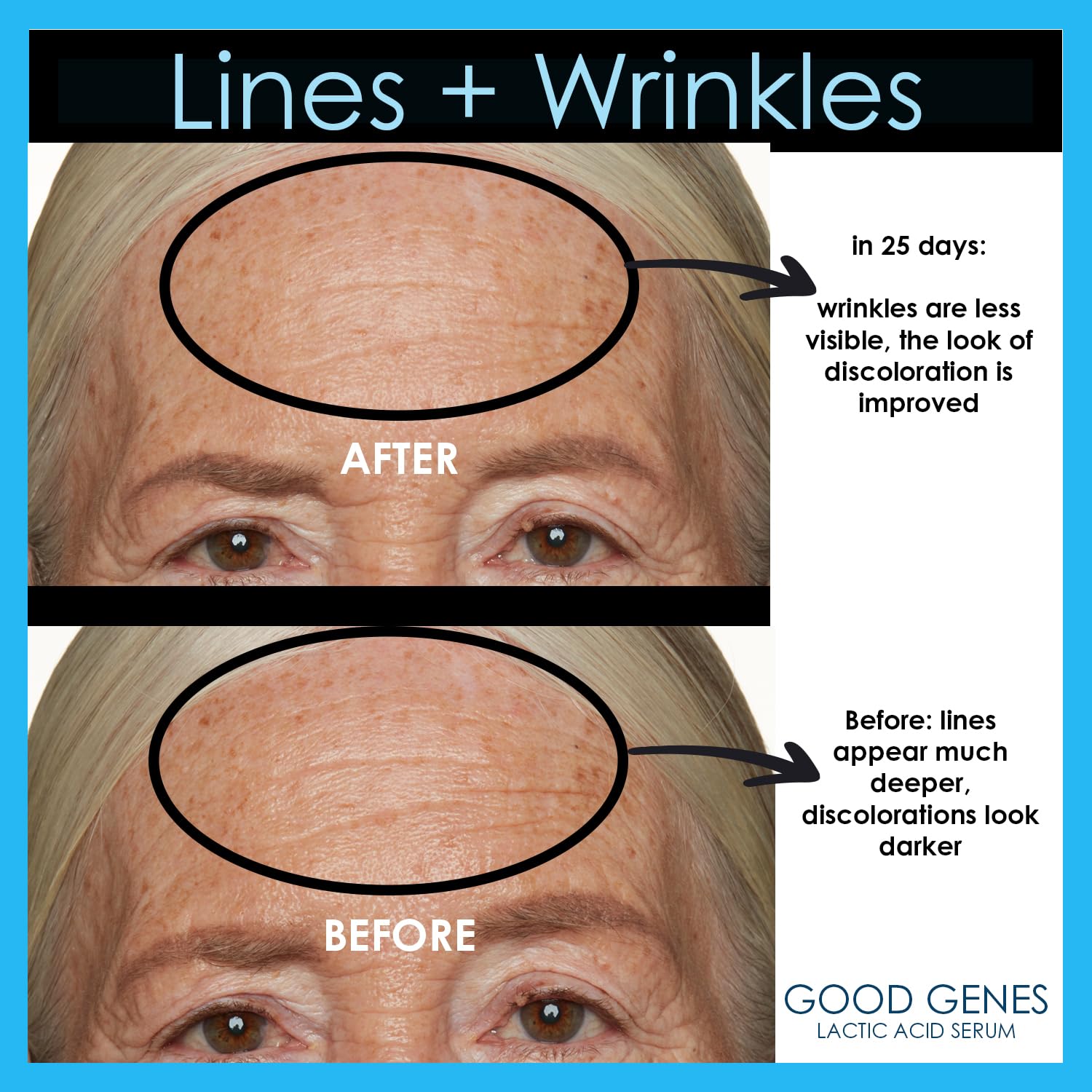 Skin radiance close-up after applying Sunday Riley Good Genes serum.