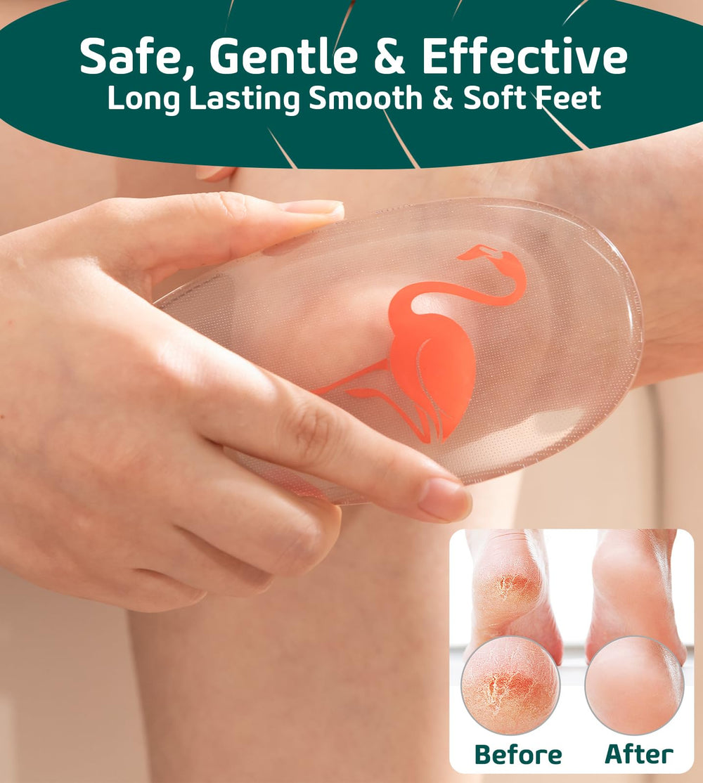 Sunivaca foot scrubber glass file cleans and softens rough areas.