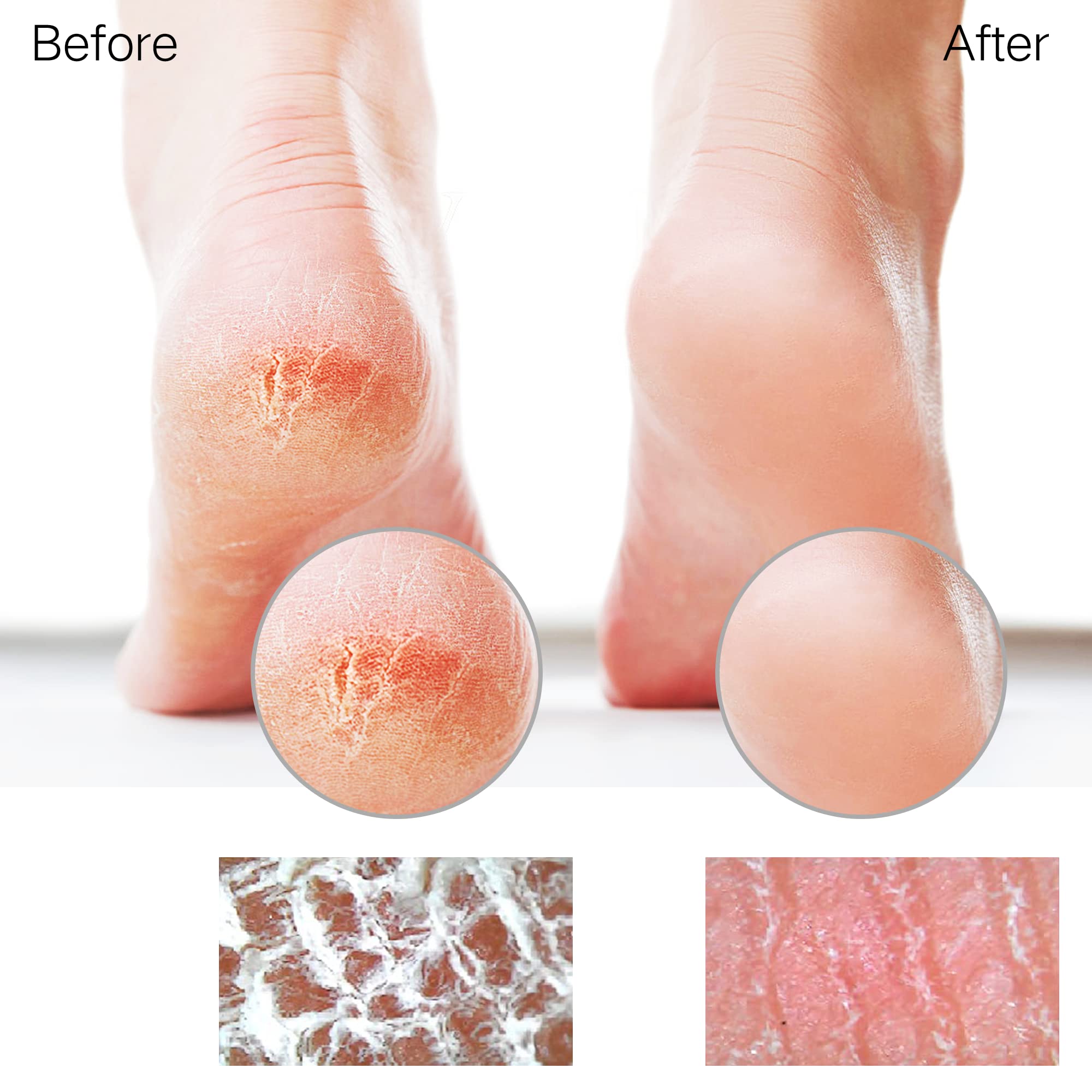 Sunivaca Nano Points maintain sharpness for long-lasting exfoliation sessions.