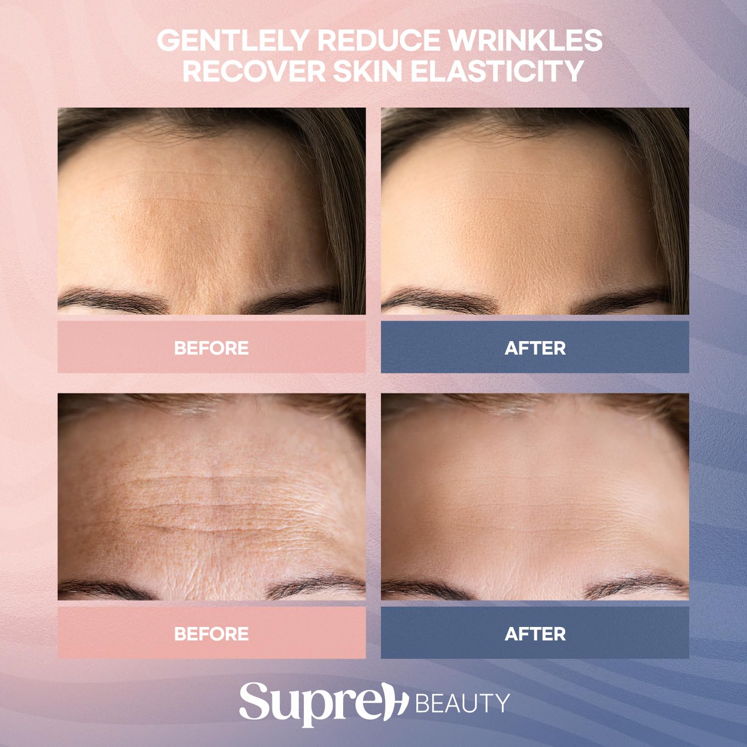 SupreH forehead wrinkle patches closeup emphasizing hydration formula