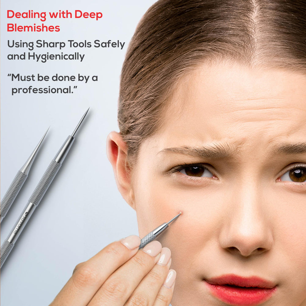 Suvorna acne needle tool enables precise popping with controlled pressure