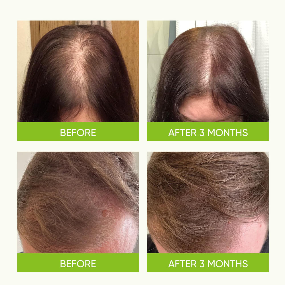 Cabello con más volumen y brillo gracias a Svvimer