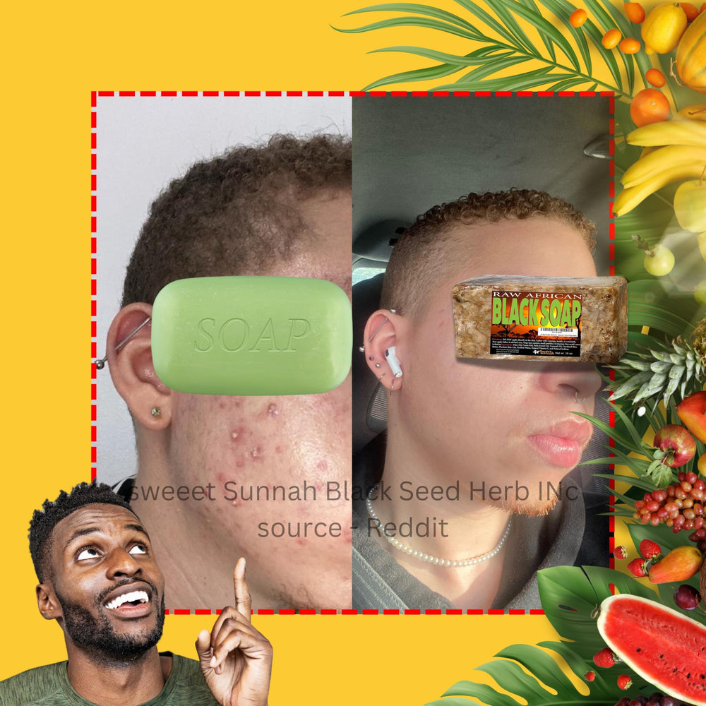 Origen Ghana de SWEET SUNNAH BLACK SEED jabon africano