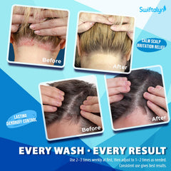 Swiftalyn Antifungal Shampoo close-up reveals rich lather for gentle cleansing.