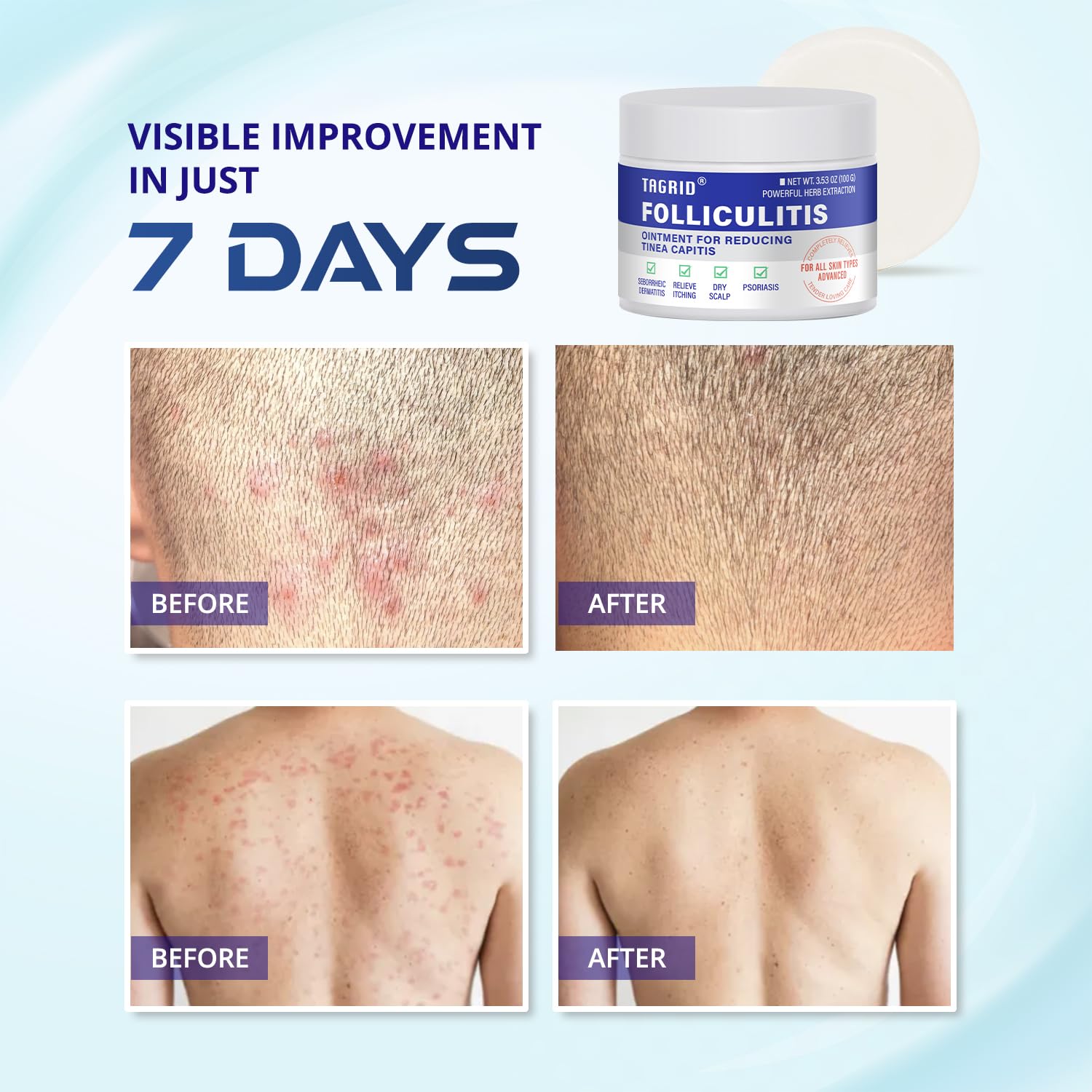Hands applying TAGRID Cream demonstrates quick absorption and soothing feel.
