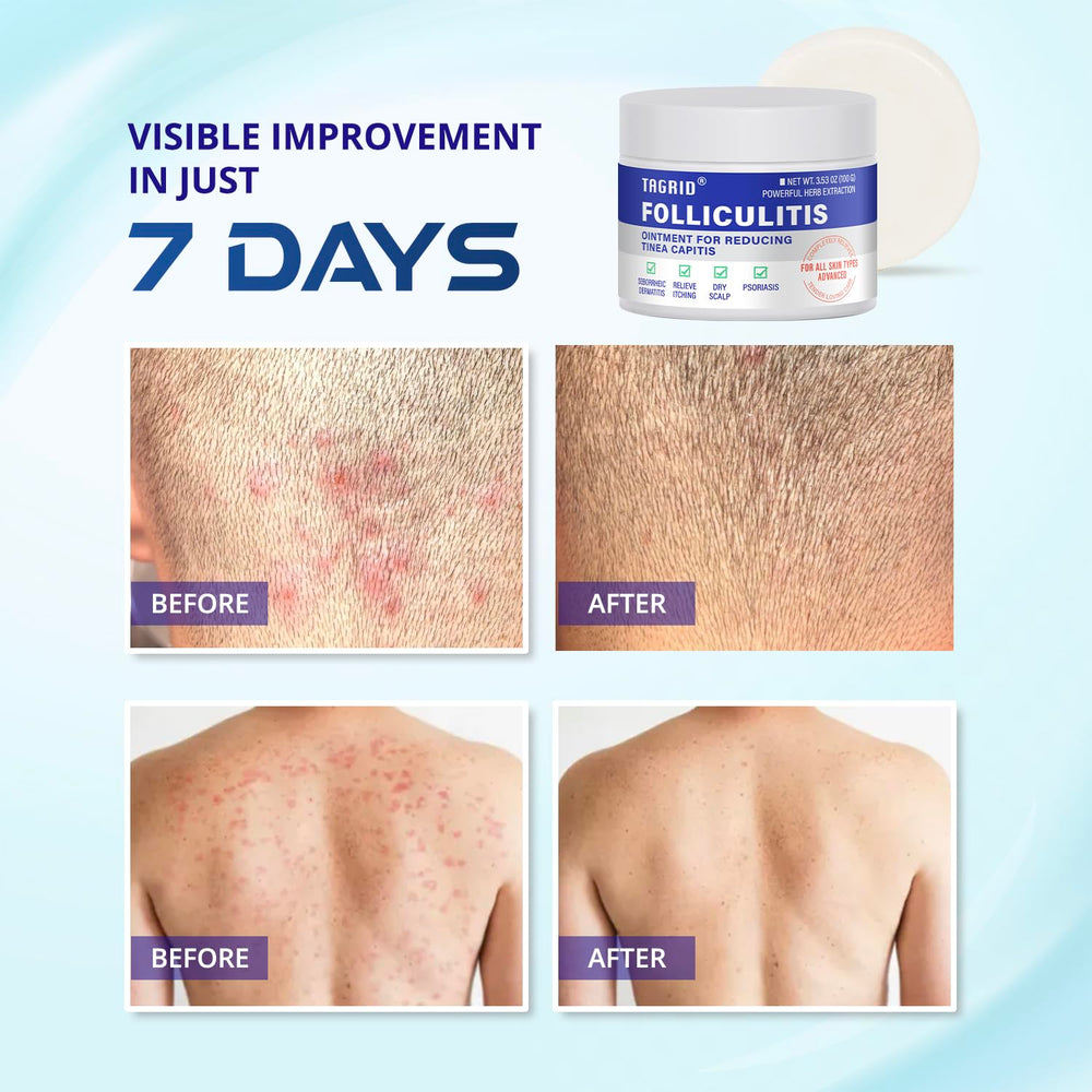 Hands applying TAGRID Cream demonstrates quick absorption and soothing feel.