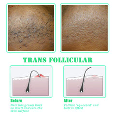 TailaiMei exfoliating brush for neck to reduce friction and reveal softness.