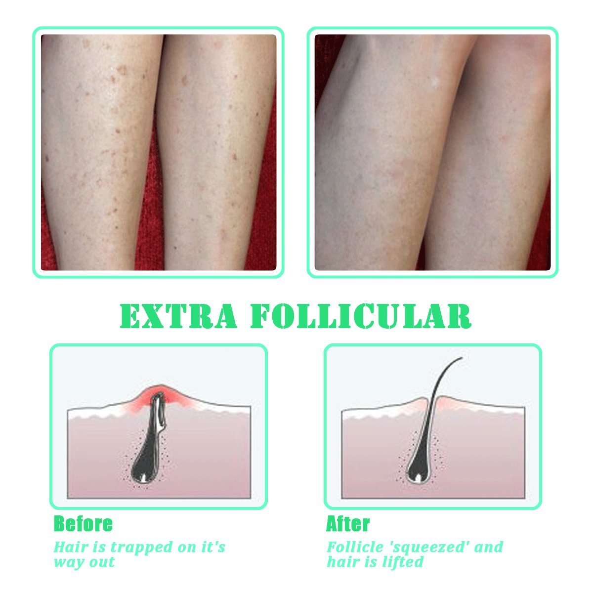 TailaiMei exfoliating brush for underarms to soothe and prep skin.