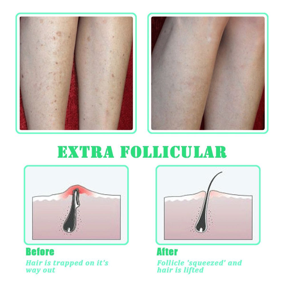 TailaiMei exfoliating brush for underarms to soothe and prep skin.