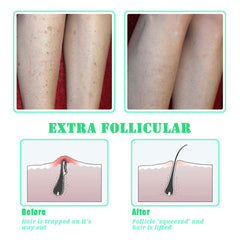 TailaiMei exfoliating brush for underarms to soothe and prep skin.