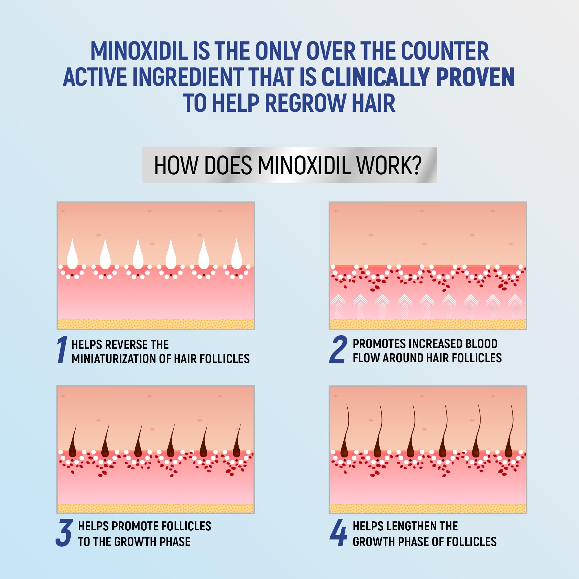TARO Minoxidil foam 1-month supply visual indicates consistent use