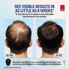 TARO Minoxidil para hombres: mayor densidad capilar con uso continuo