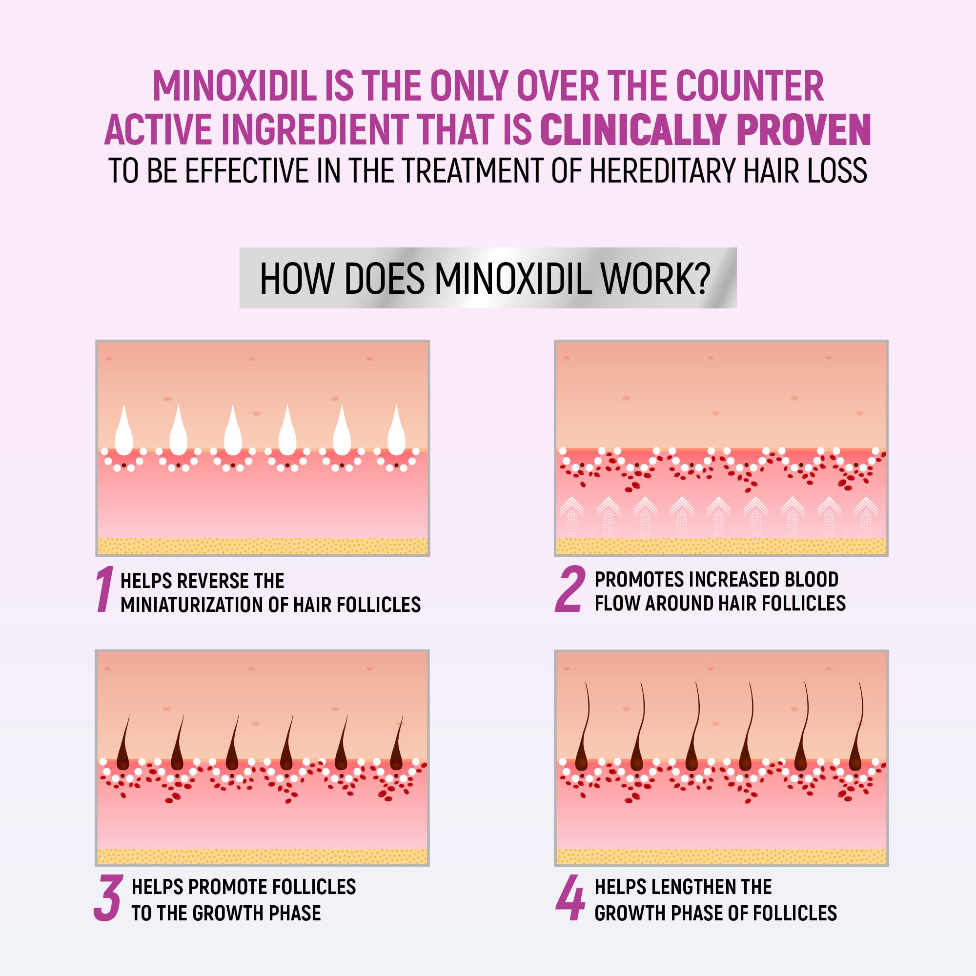 TARO Minoxidil para mujer aumenta densidad capilar en zonas débiles
