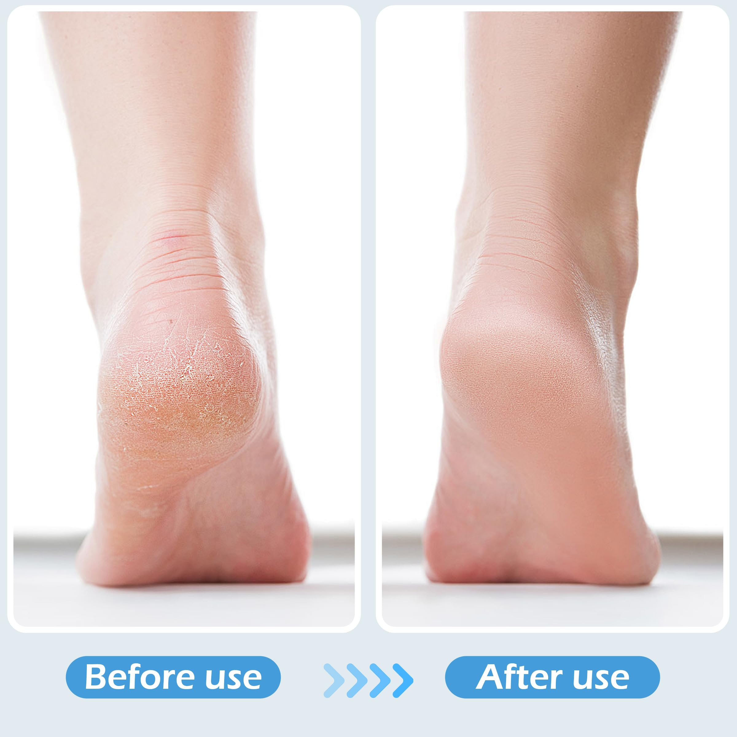 TaShow pumice stone exfoliation for feet in a compact kit
