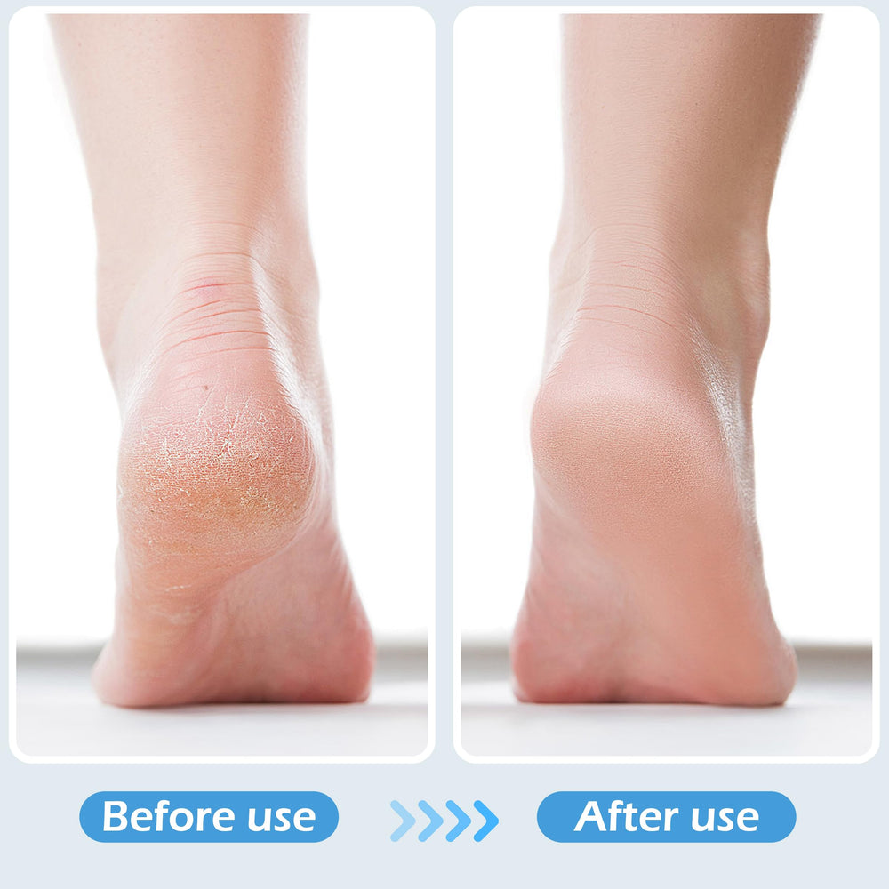 TaShow pumice stone exfoliation for feet in a compact kit