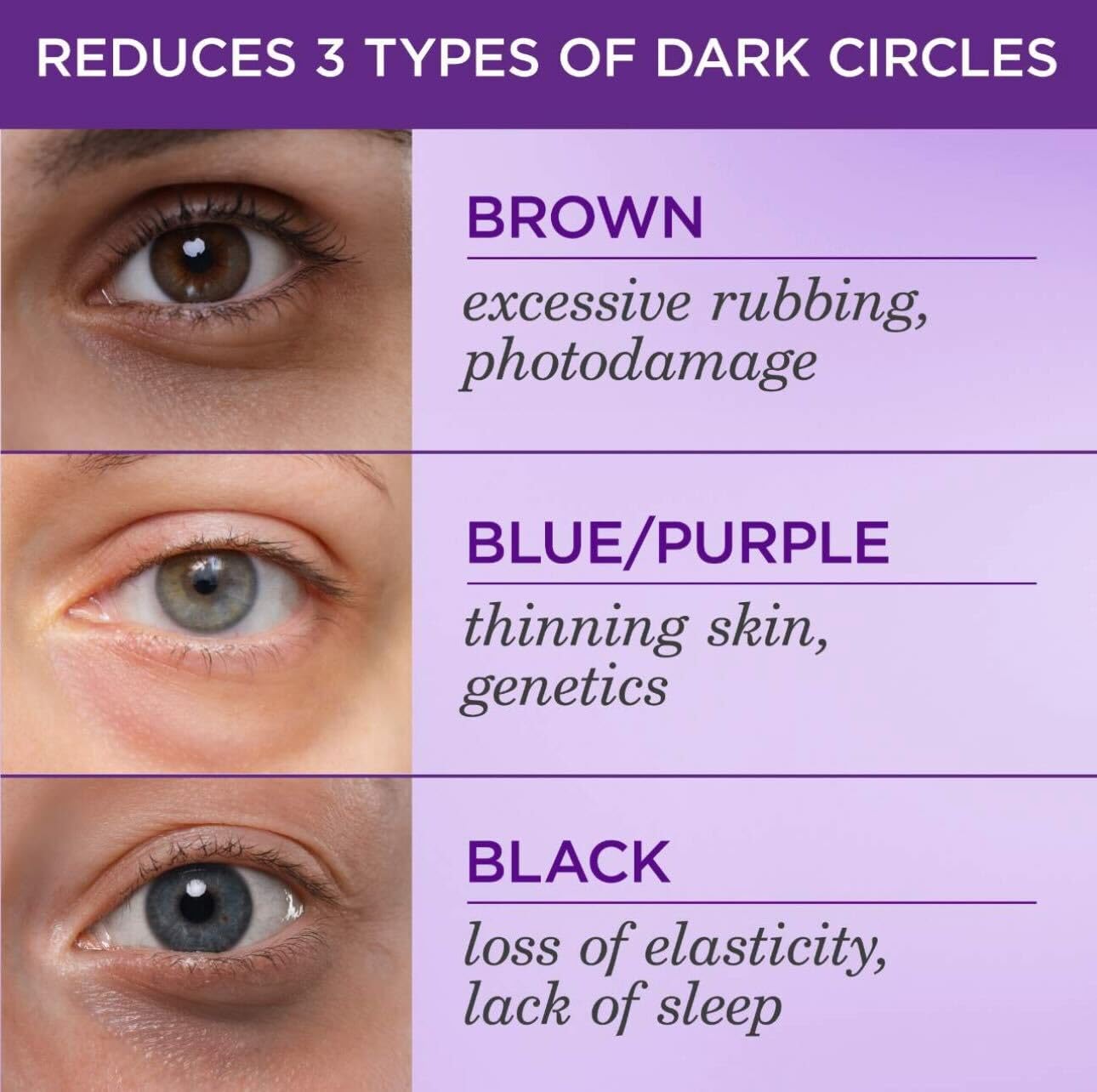 Close-up under-eye area with TATCHA Brightening Eye Cream brightening effect.
