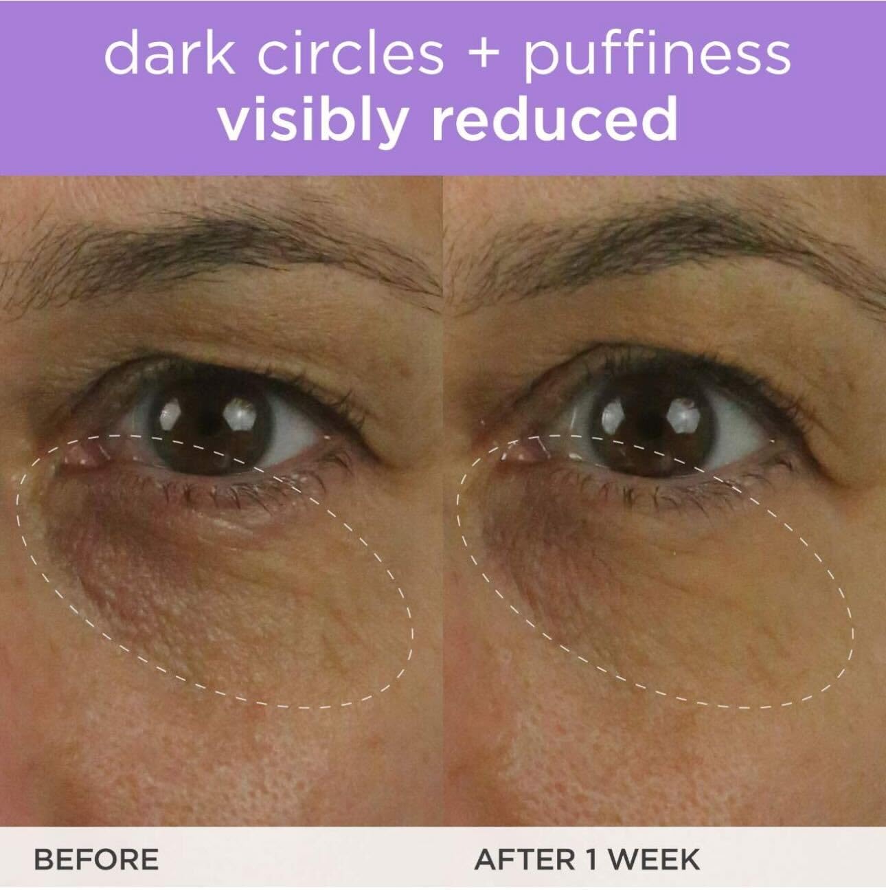 Vitamin C ingredient close-up from TATCHA Brightening Eye Cream.