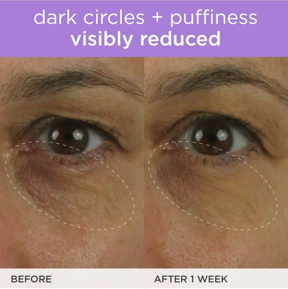 Vitamin C ingredient close-up from TATCHA Brightening Eye Cream.