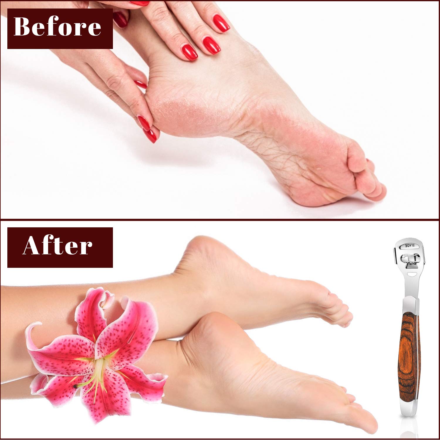 TCocos Professional Home Pedicure Set for versatile care at home