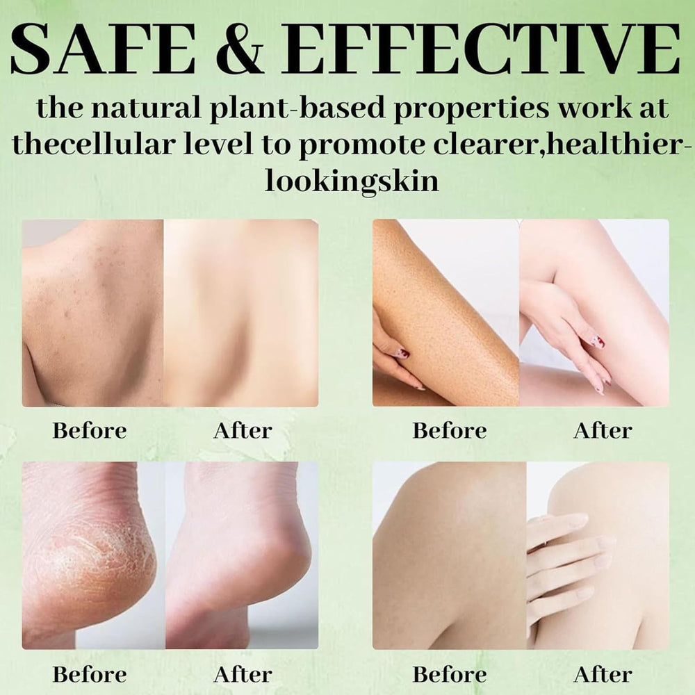 Tea Tree Soap gentle exfoliation reveals smoother, brighter skin.