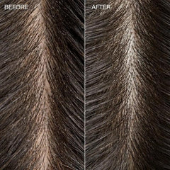 Tea Tree Detox Scrub foam applied to the scalp during treatment.