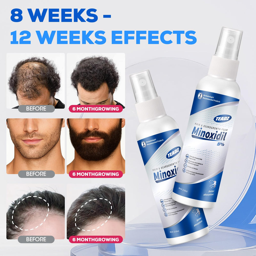 TEADZ Minoxidil ingredients include castor oil and aloe for scalp nourishment.