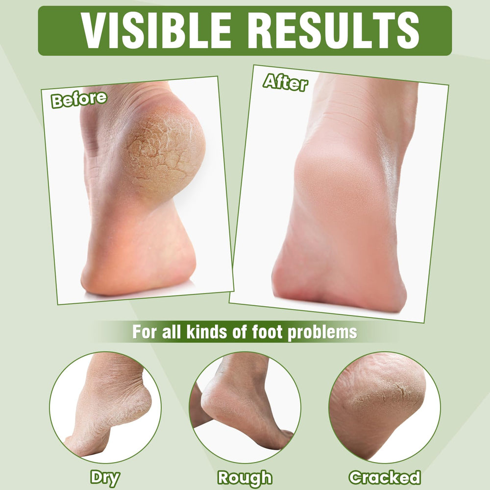 TEAWOO foot mask with vitamin E to soothe and protect cracked areas