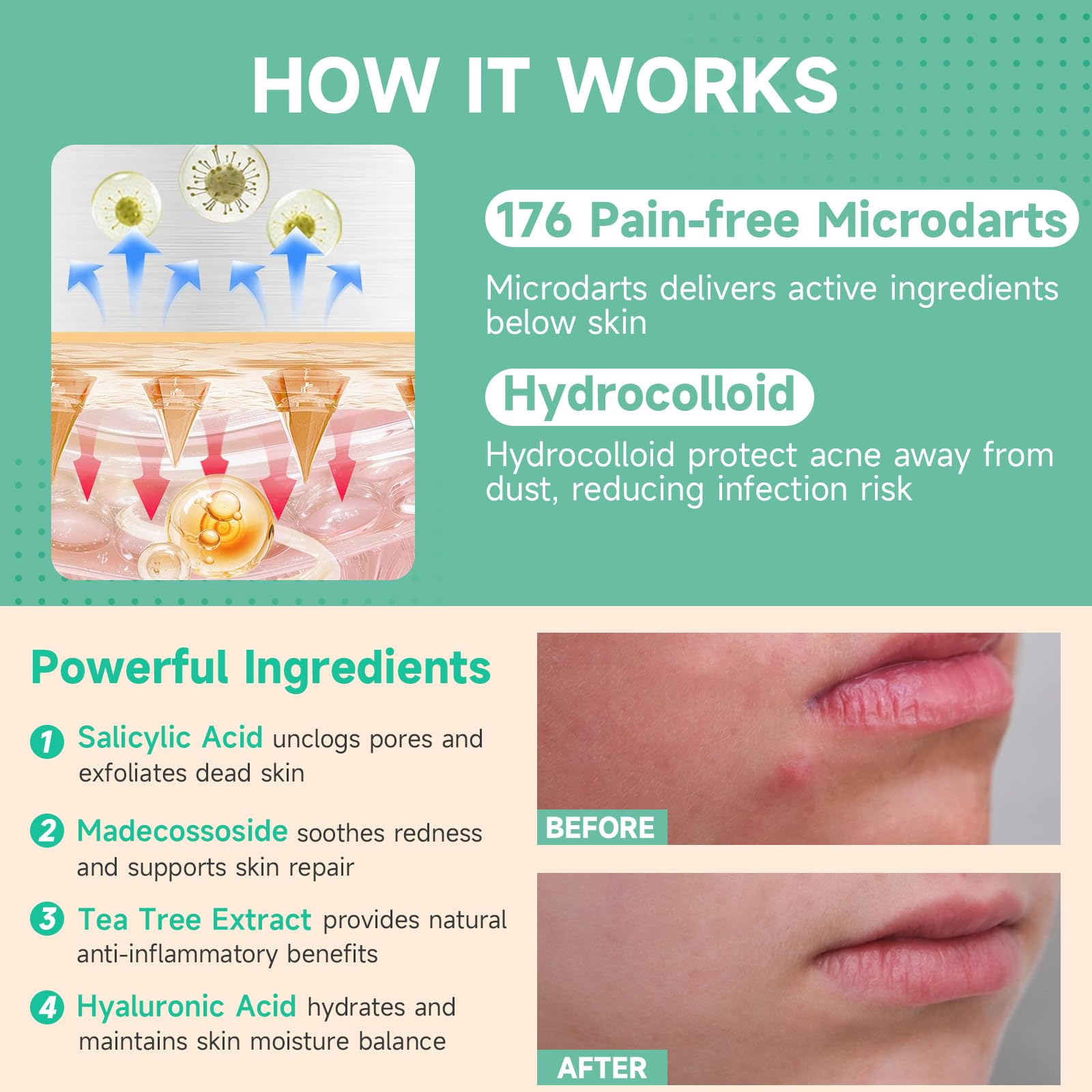 TEAWOO Microdart patches used at night for convenient routine.