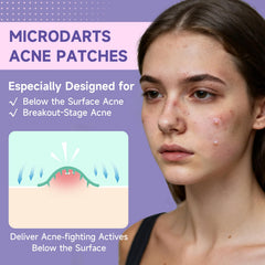 Parches TEAWOO con diseño multiforma rosado para diferentes áreas del rostro