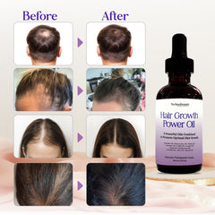 Technobeauty Aceite Batana para hidratar y proteger el cabello