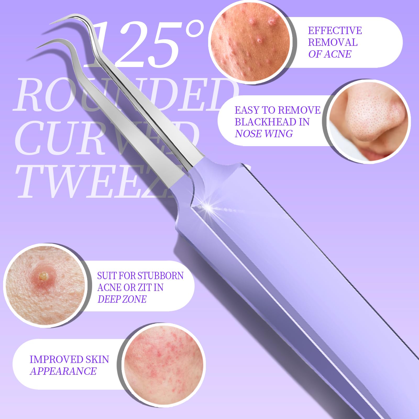 Teenitor ergonomic pimple extractor with anti-slip grip supports precise control during extractions.