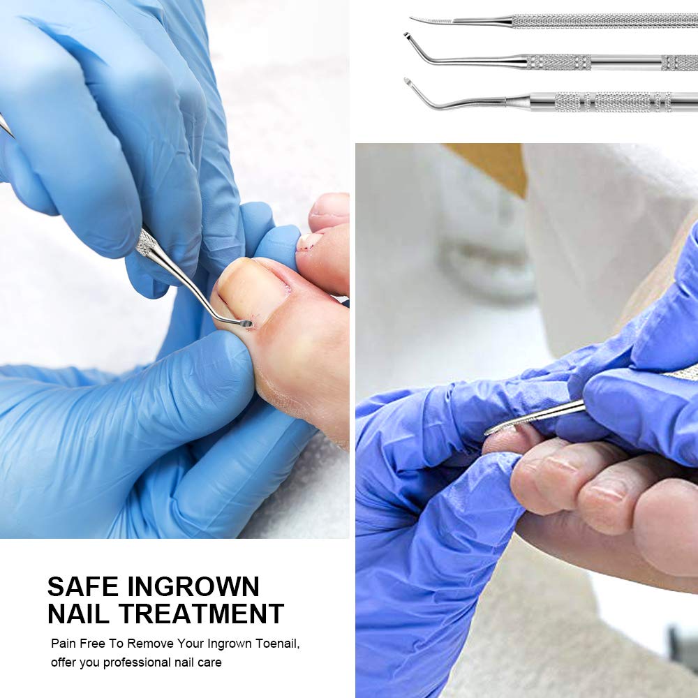 Teenitor home pedicure solution kit for convenient at-home care.