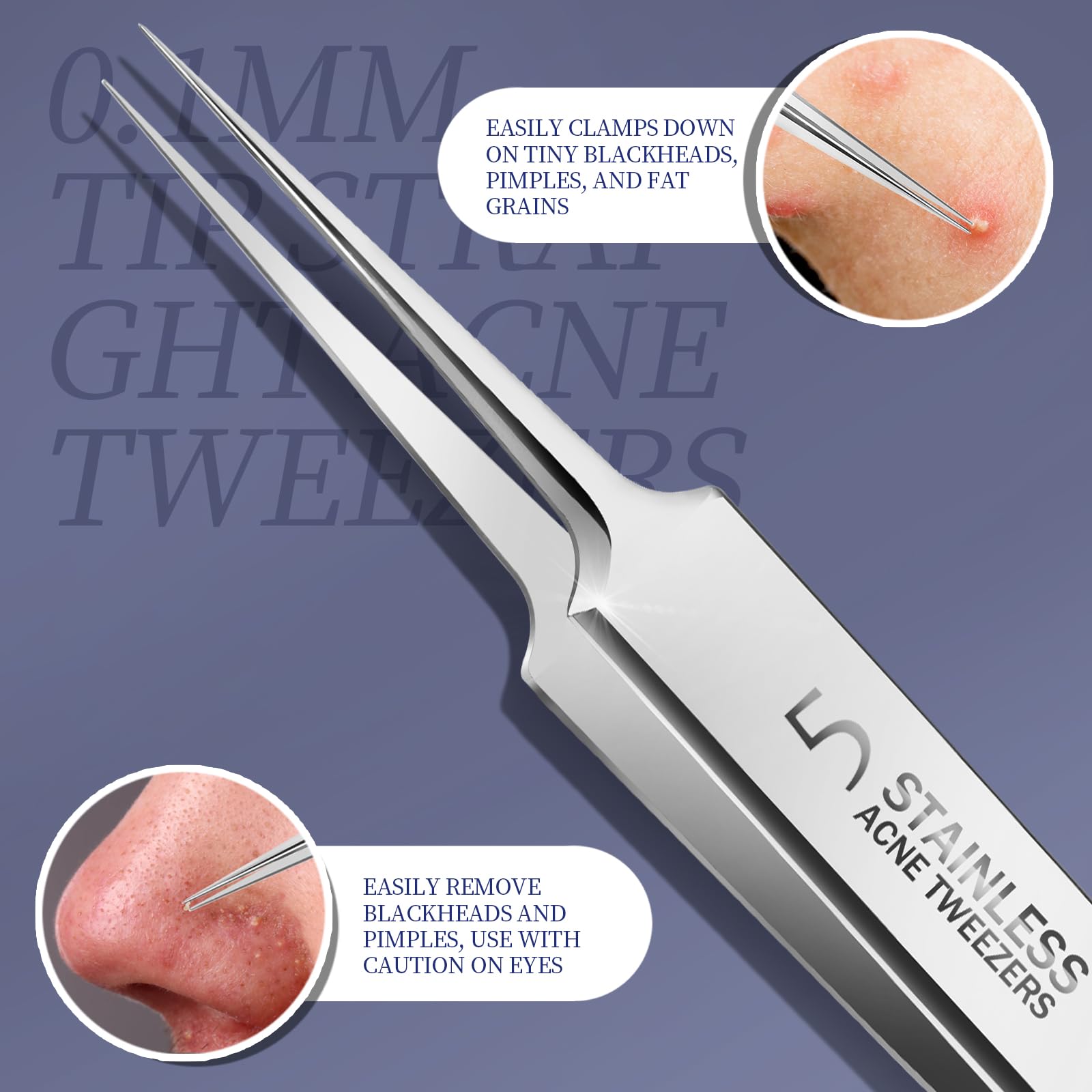 Teenitor ingrown hair tweezers ready for precise hair removal and eyebrow shaping.