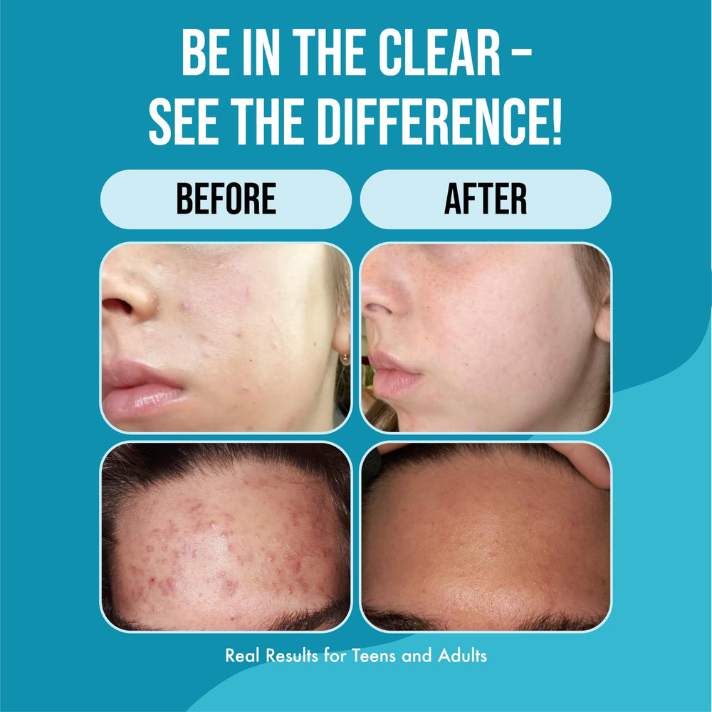 Teenology Teen Shampoo being applied creates rich lather for daily washing.