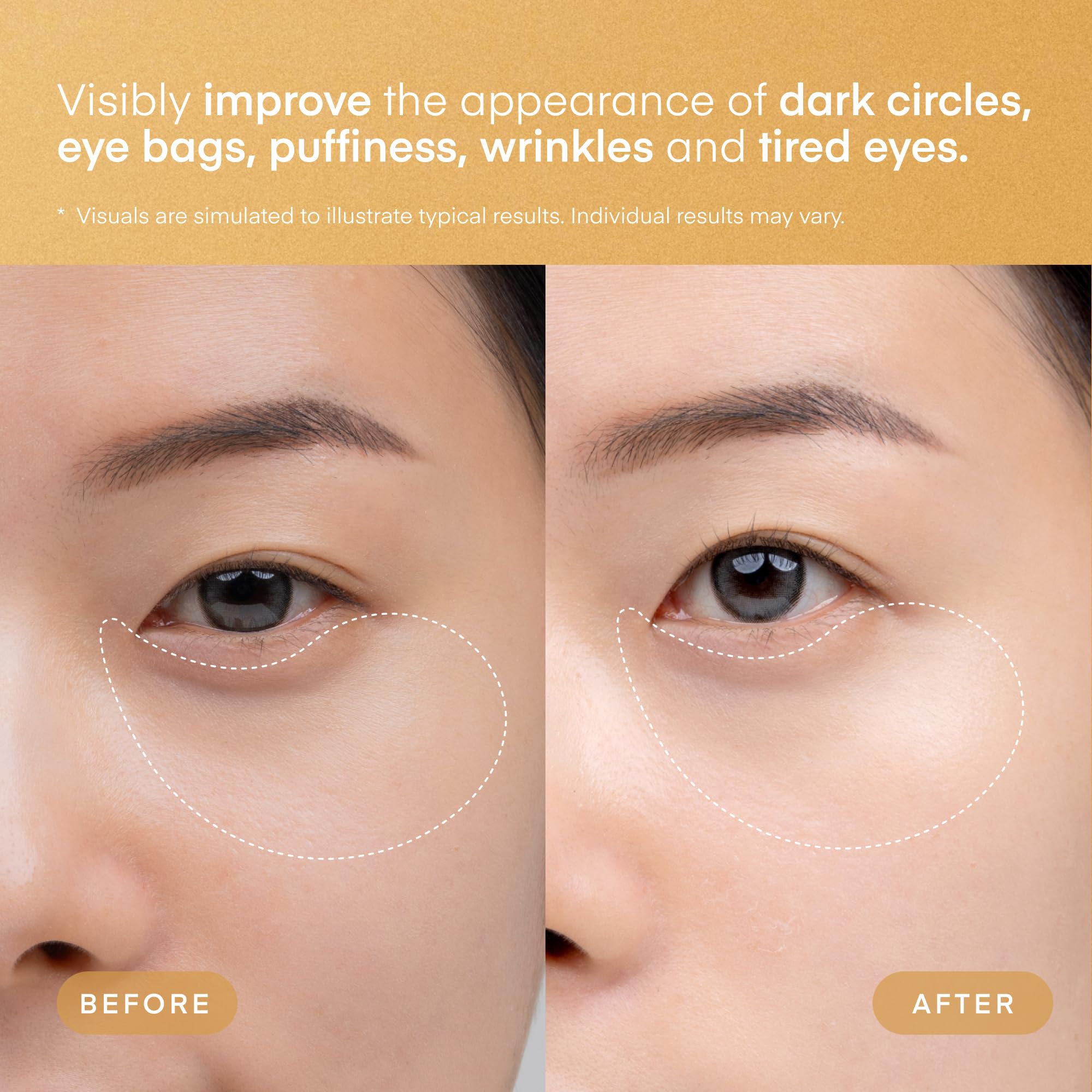 TEREZ & HONOR gold finish visible on skin for a luxe treatment feel.
