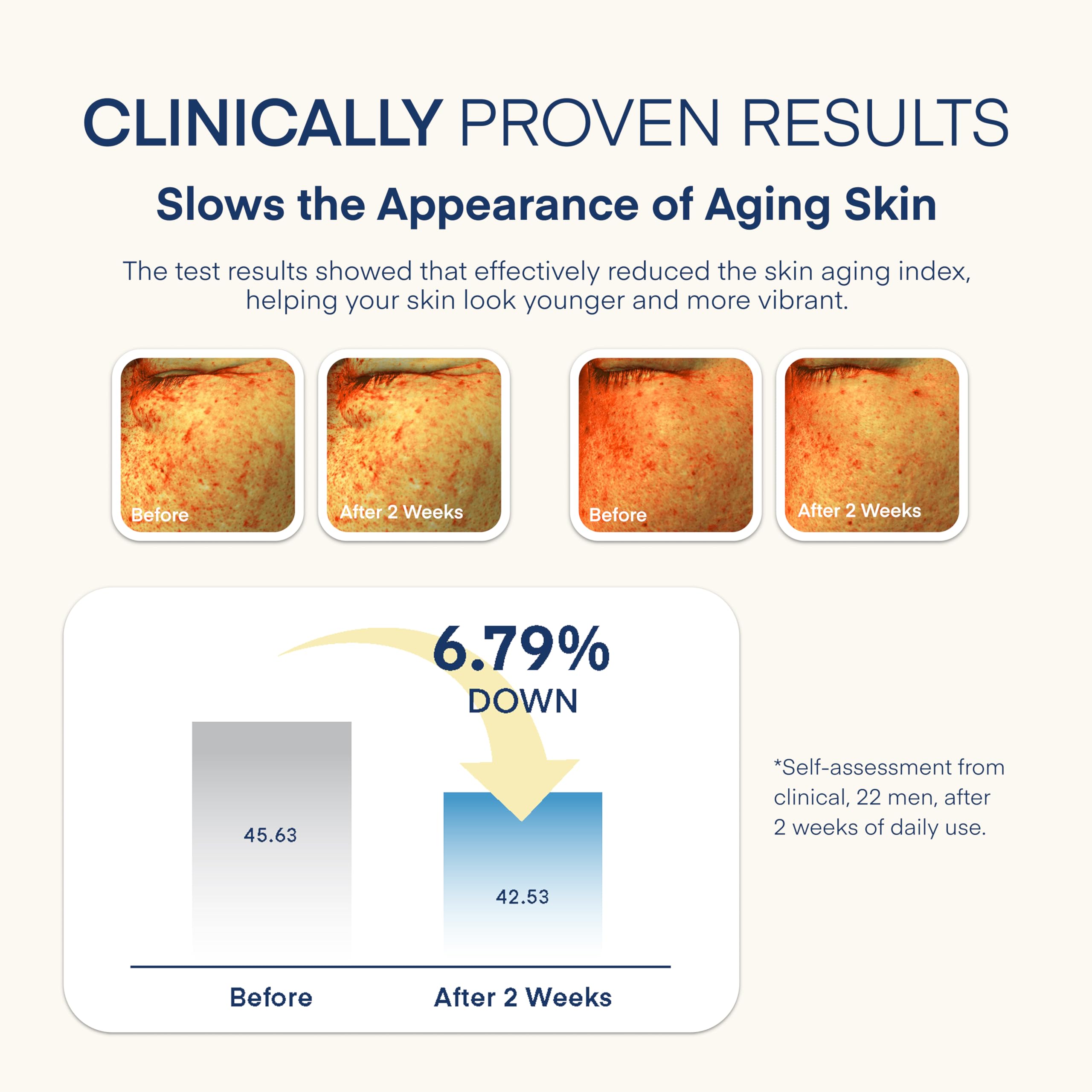 Skin shows hydrated, non-greasy finish after applying TEREZ & HONOR cream.