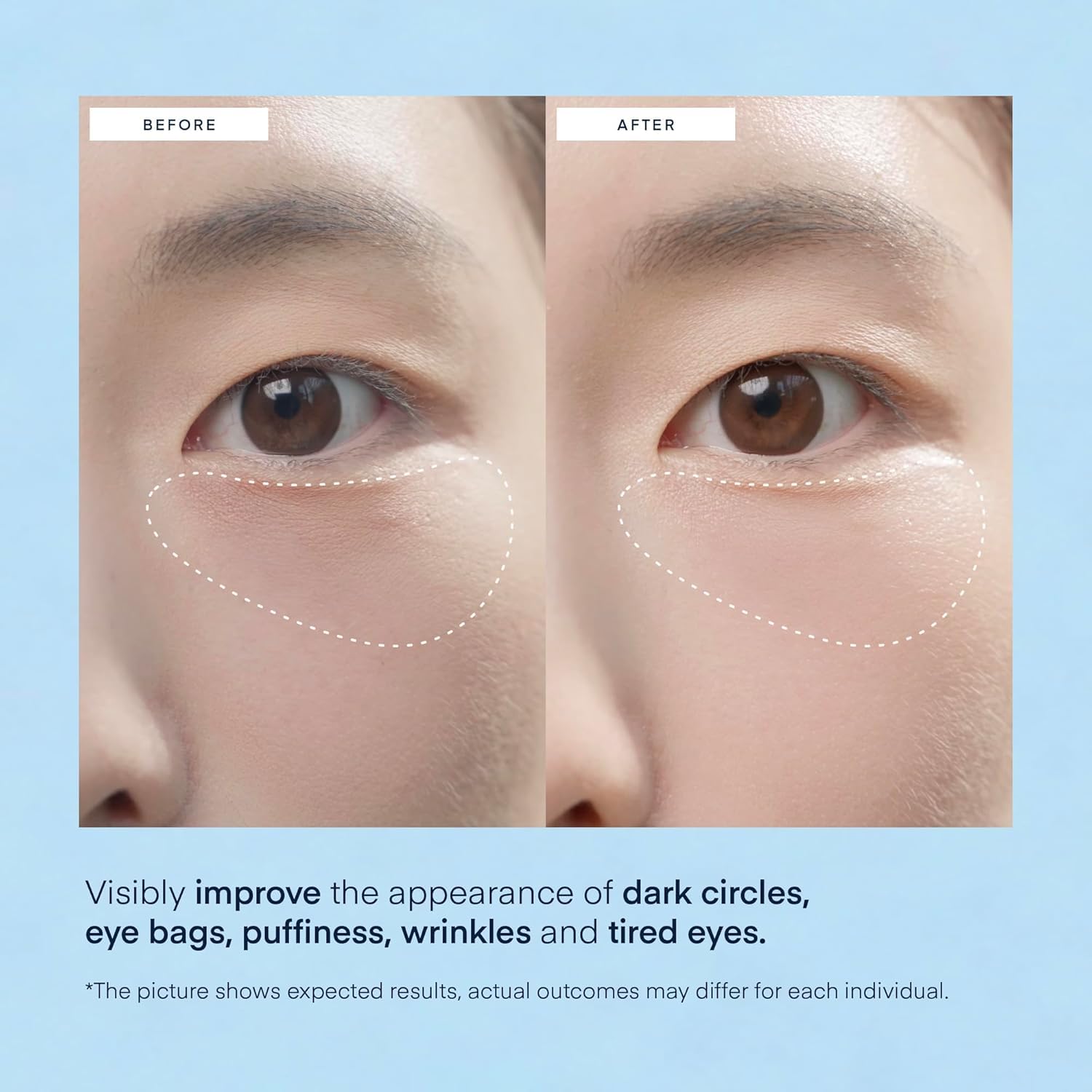 TEREZ & HONOR caffeine-infused patches reduce puffiness around the eyes.