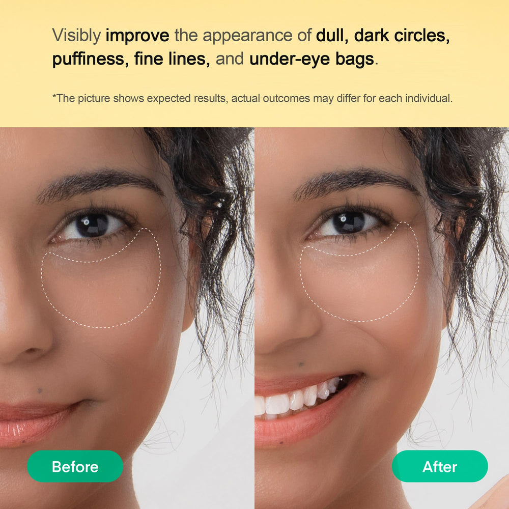 TEREZ & HONOR patches showcase 9-layer hyaluronic surge for deep hydration and plumping.