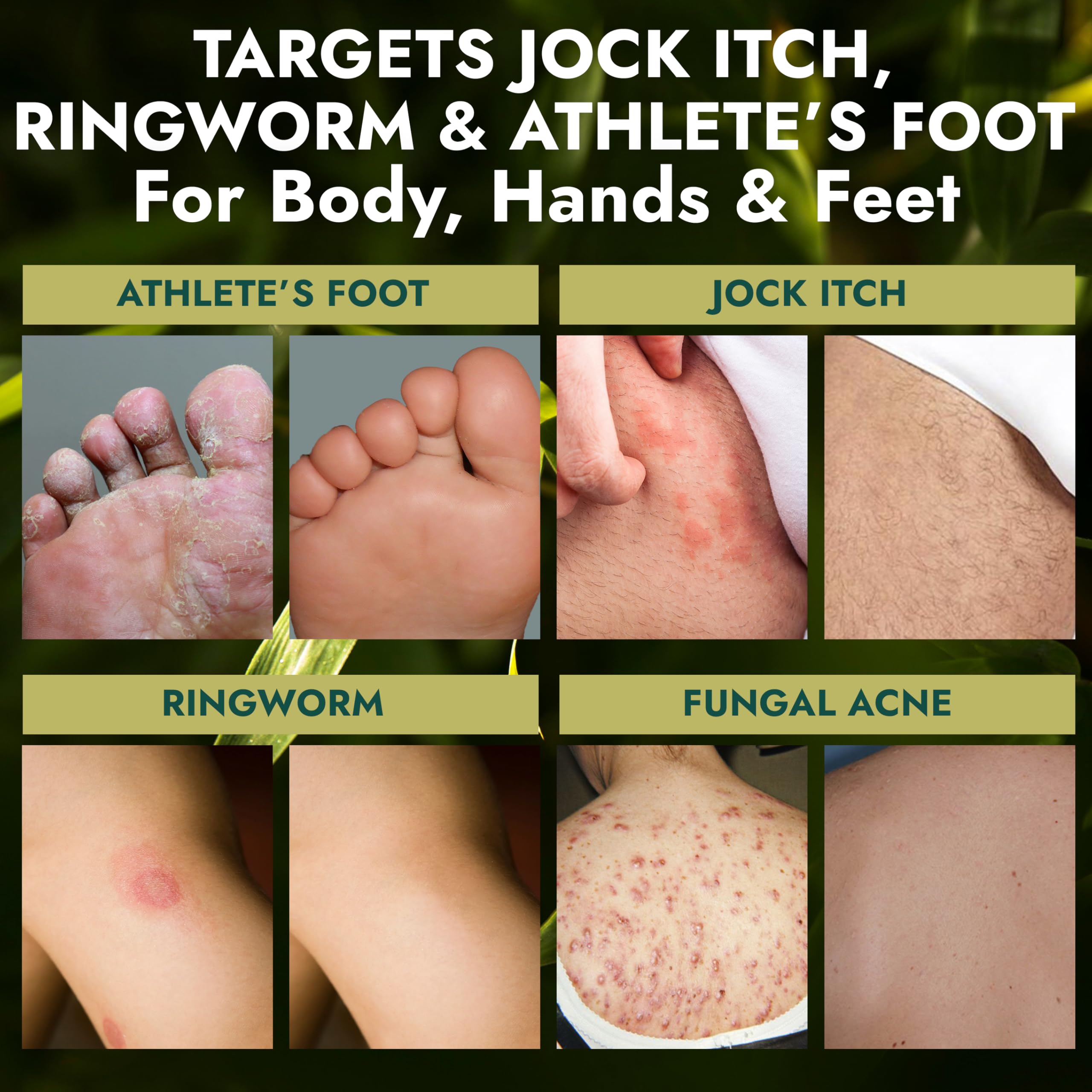 Terramed Just Think Comfort athletes foot treatment after workouts.