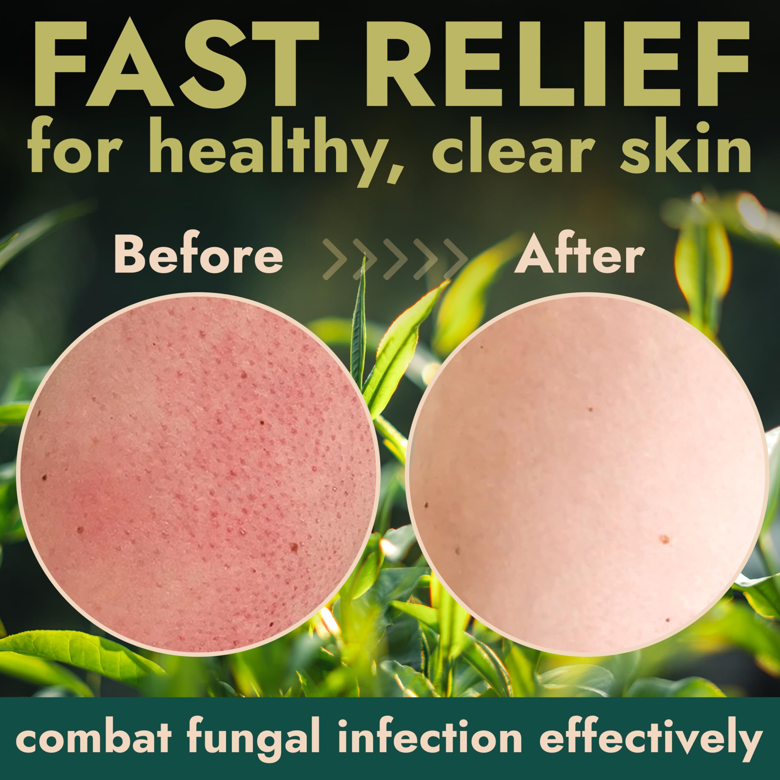 Terramed Just Think Comfort bottle highlights tea tree oil and aloe vera