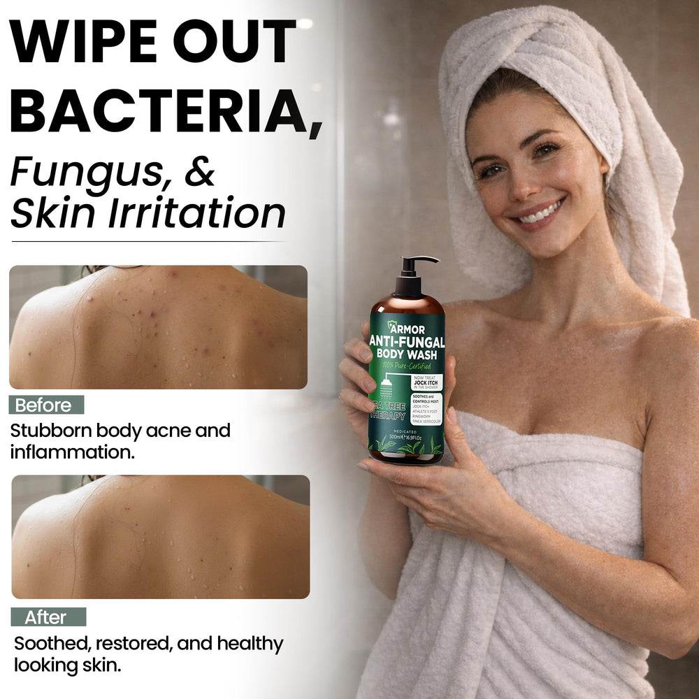 Terramed organic ingredients and aloe vera in antifungal wash for hydration.