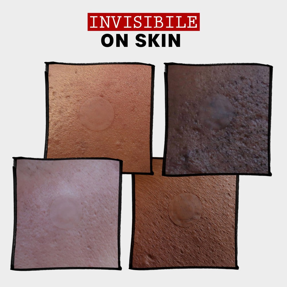 Patch applied to blemish on face, demonstrating discreet coverage.
