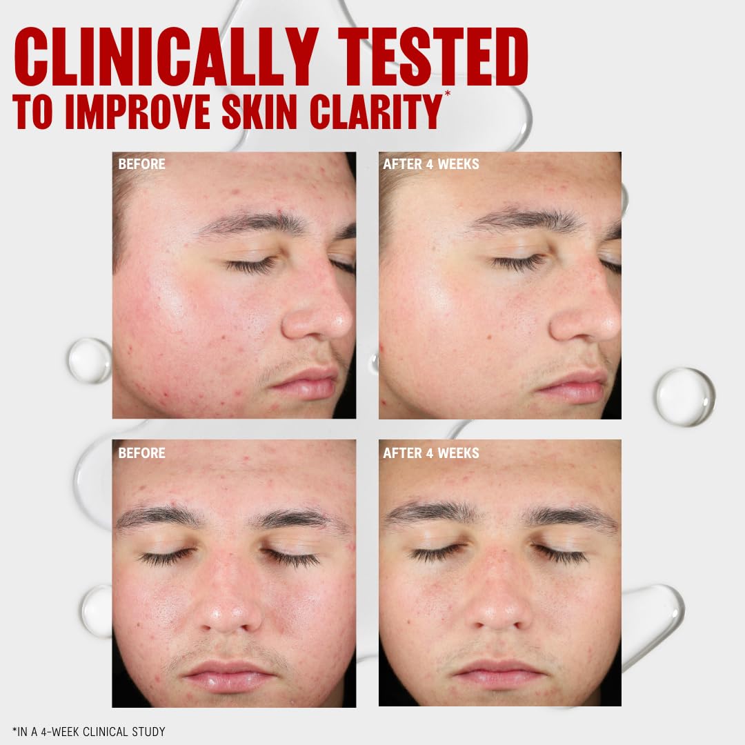 Tónico THAYERS dermatológicamente probado para seguridad y resultados.